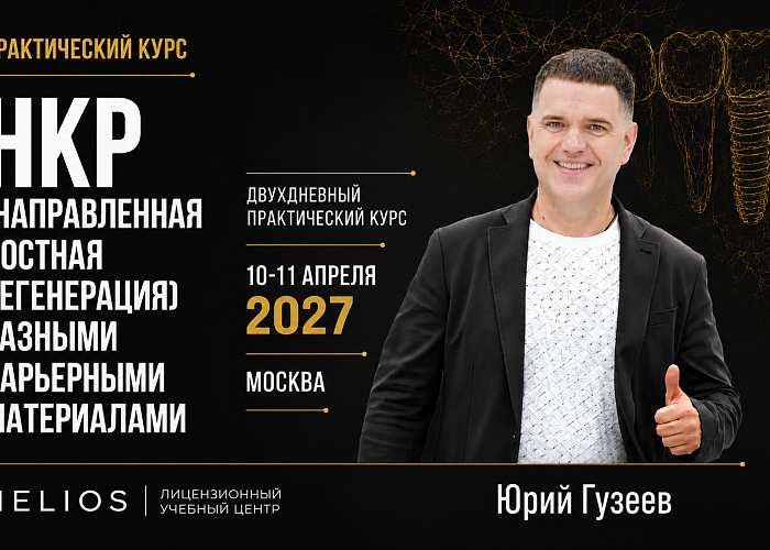 «НКР (направленная костная регенерация) разными барьерными материалами»