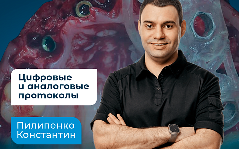 ТОТАЛЬНЫЕ РЕАБИЛИТАЦИИ НА 4-6 ИМПЛАНТАТАХ С ИСПОЛЬЗОВАНИЕМ ЦИФРОВЫХ И АНАЛОГОВЫХ ПРОТОКОЛОВ