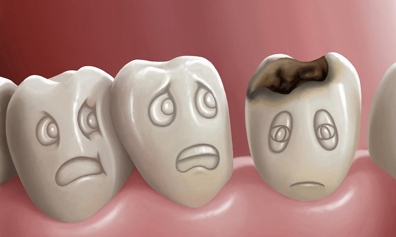 Почему наши зубы портятся?