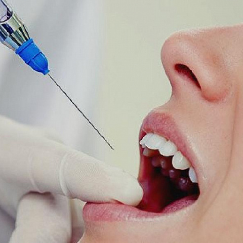 Выбор типа анестетика и техники анестезии для всех групп зубов