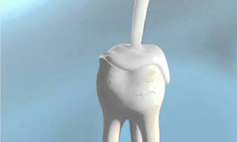 Крем восстанавливает поврежденную зубную эмаль