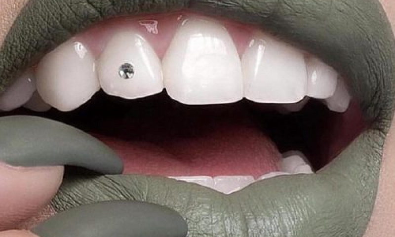 Самые странные тренды в современной стоматологии