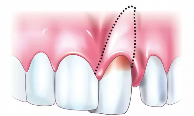 Переломы и вывихи зубов: причины распространенных ошибок и способы их предотвращения