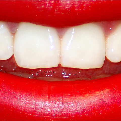 Роль гнатологического обследования в устранении нарушений окклюзионных взаимоотношений зубов при заболеваниях пародонта