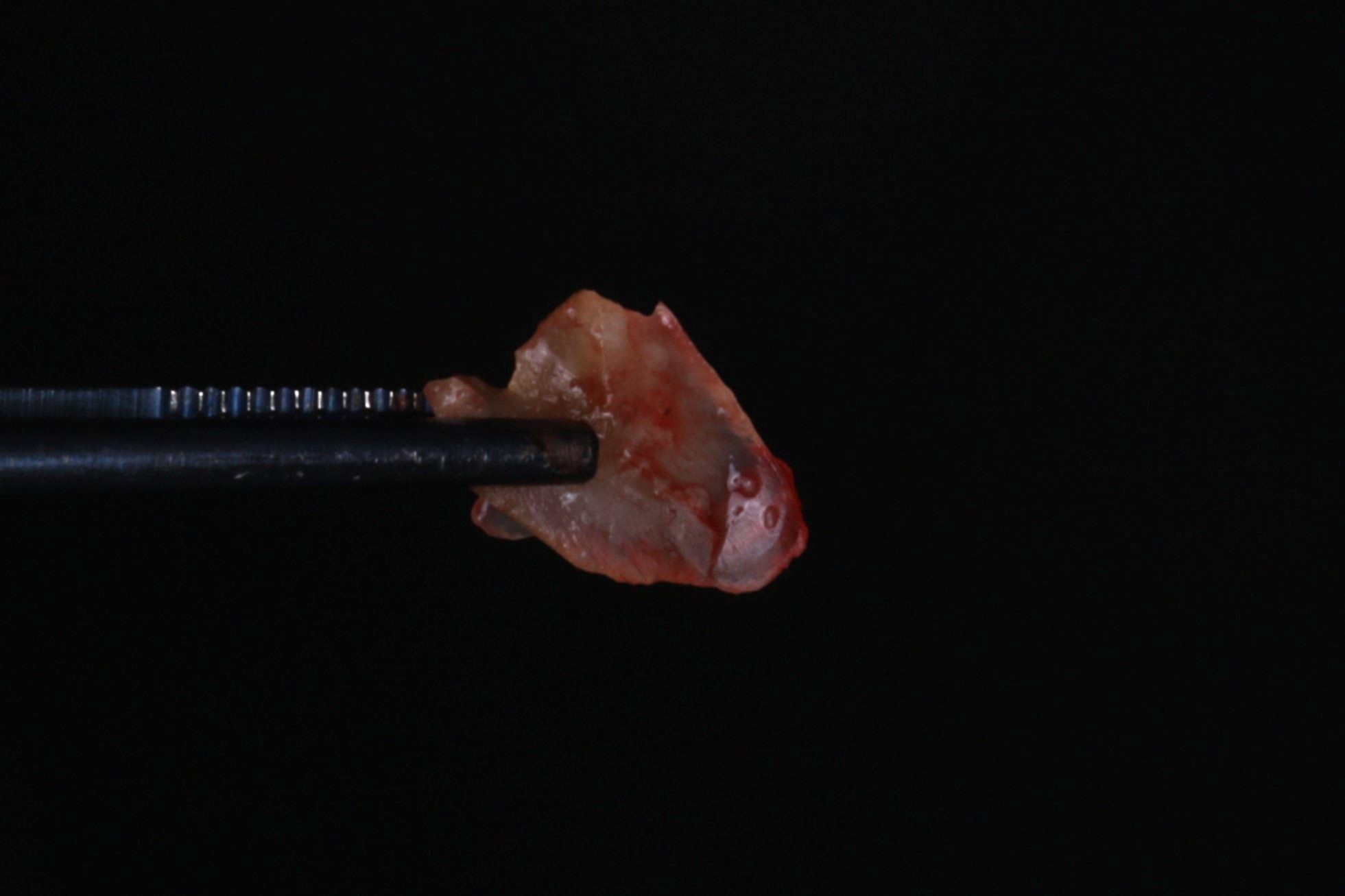 Отломок корня 