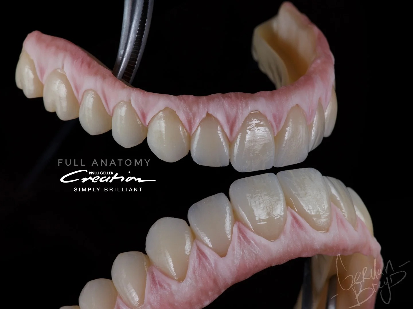 «Цельноциркониевые коронки с уровня имплантата. Винтовая фиксация»