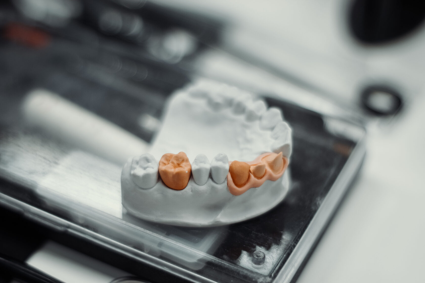 «Виниры «на рефракторе» + работа с диоксидом циркония + дисиликат лития. Коронки, виниры, накладки. Особенности интеграции цветовых особенностей разны