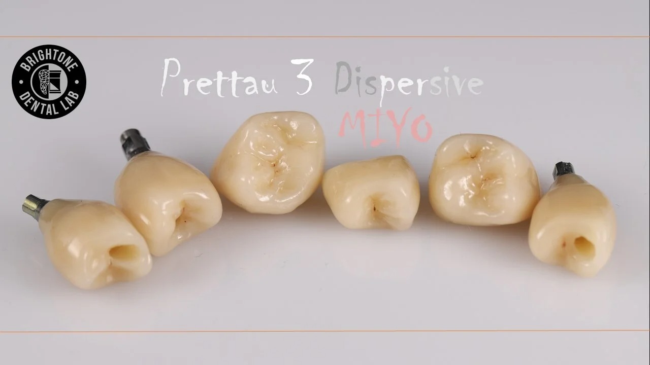 «Планирование тотальных работ в ExoCad + 3D печать. Работа на имплантатах в цифровом и мануальном протоколе»