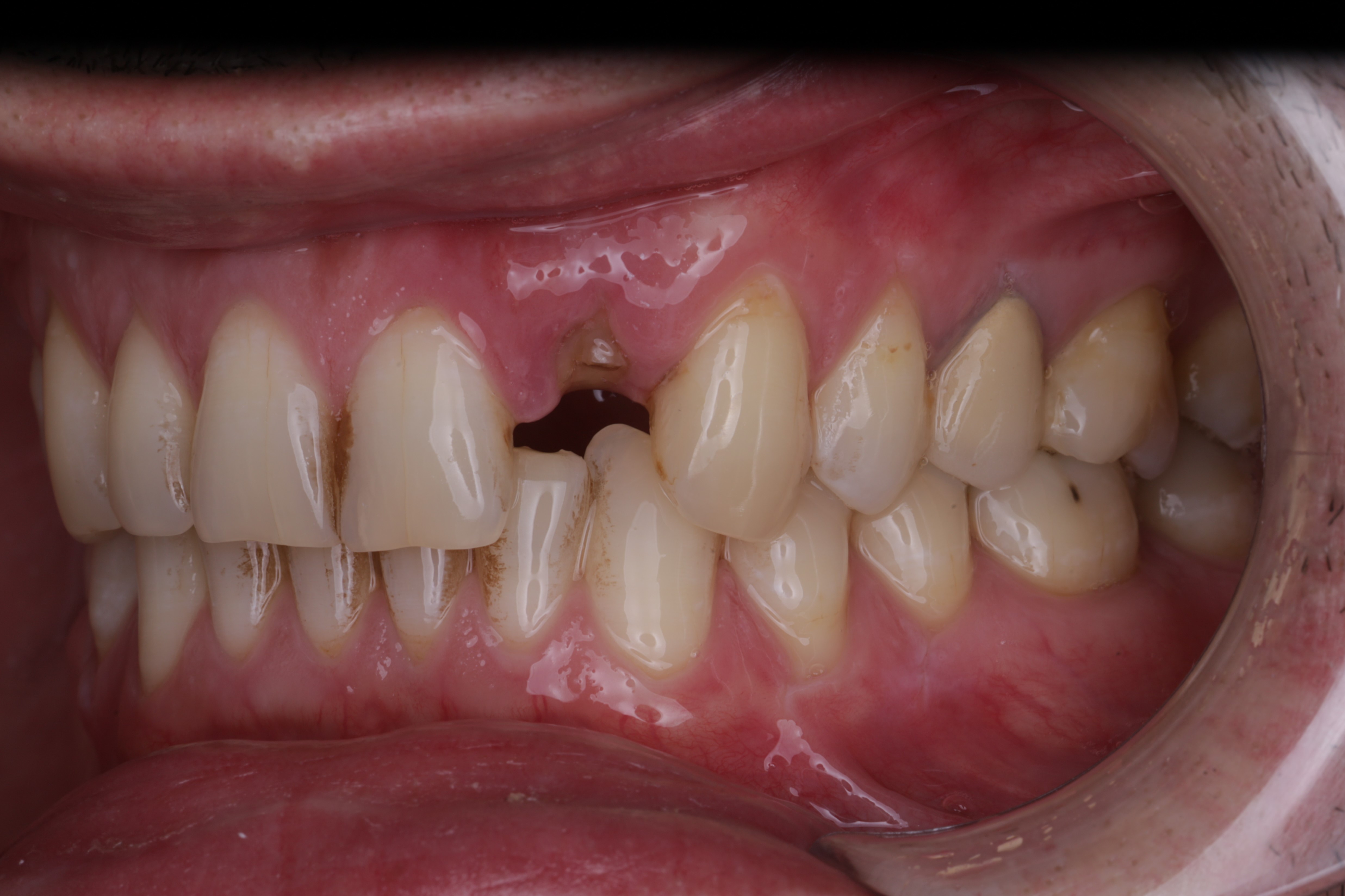 Исходная клиническая ситуация 