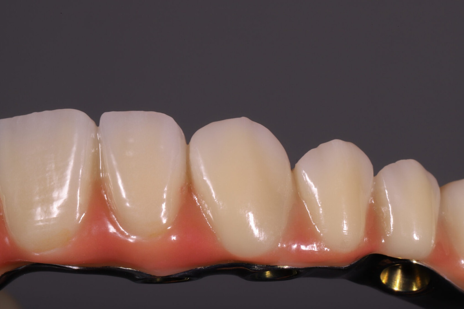 «Протокол тотального протезирования при полной адентии»