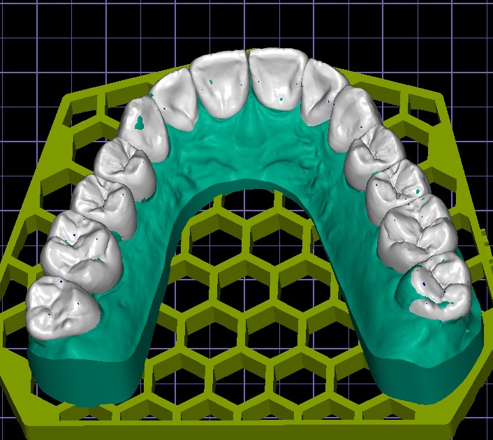 «Моделирование функции и эстетики в программе Exocad»
